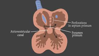 Atrial Septal Defect ASD  Part 1  Embryology Explained  Dr Saykat [upl. by Neelyahs]