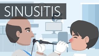 Managing Chronic Sinusitis [upl. by Haneeja479]