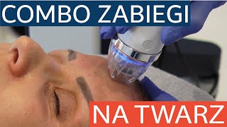 Combo zabiegi na twarz  radiofrekwencja mikroigłowa Secret RF i peeling laserowy Fraxis [upl. by Ahsienet]