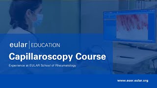 14th EULAR Course on Capillaroscopy 2025 [upl. by Zingg233]