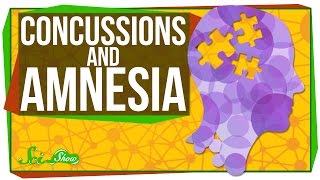 How Do Concussions Cause Amnesia [upl. by Nehepts594]