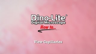 How to View Capillaries using DinoLite USB Microscopes [upl. by April]