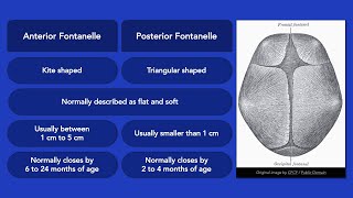 Fontanelles [upl. by Akinod]